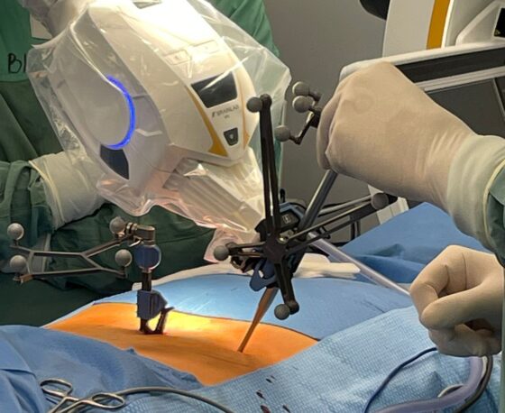 Białystok. Roboty do operacji neurochirurgicznych kupił Uniwersytecki Szpital Kliniczny